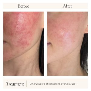 Iso-Cell Recovery Solution